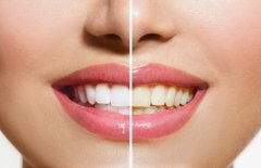 bleaching1.JPG
